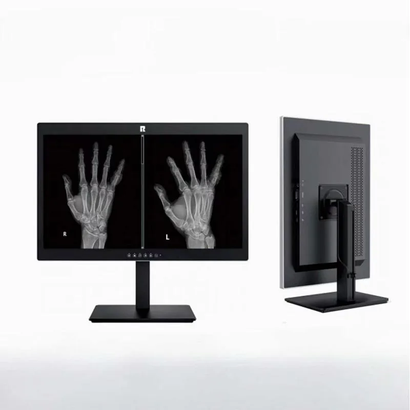 Écran de diagnostic médical 20,1 pouces 2MP