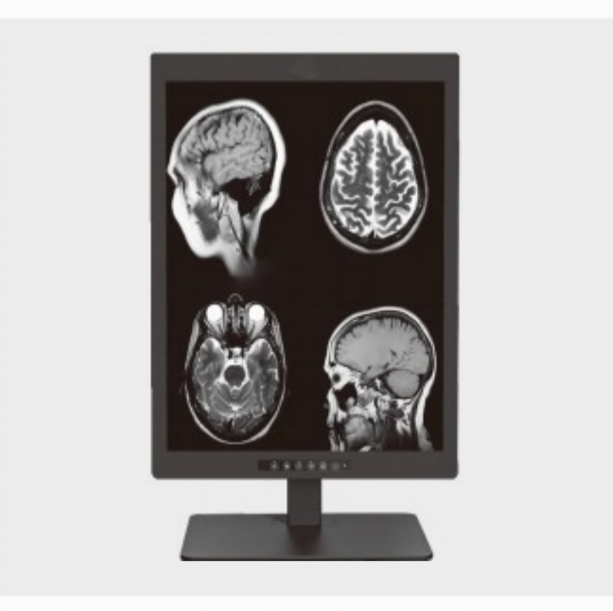 Où un écran de diagnostic médical 2MP de 20,1 pouces est-il couramment utilisé ?