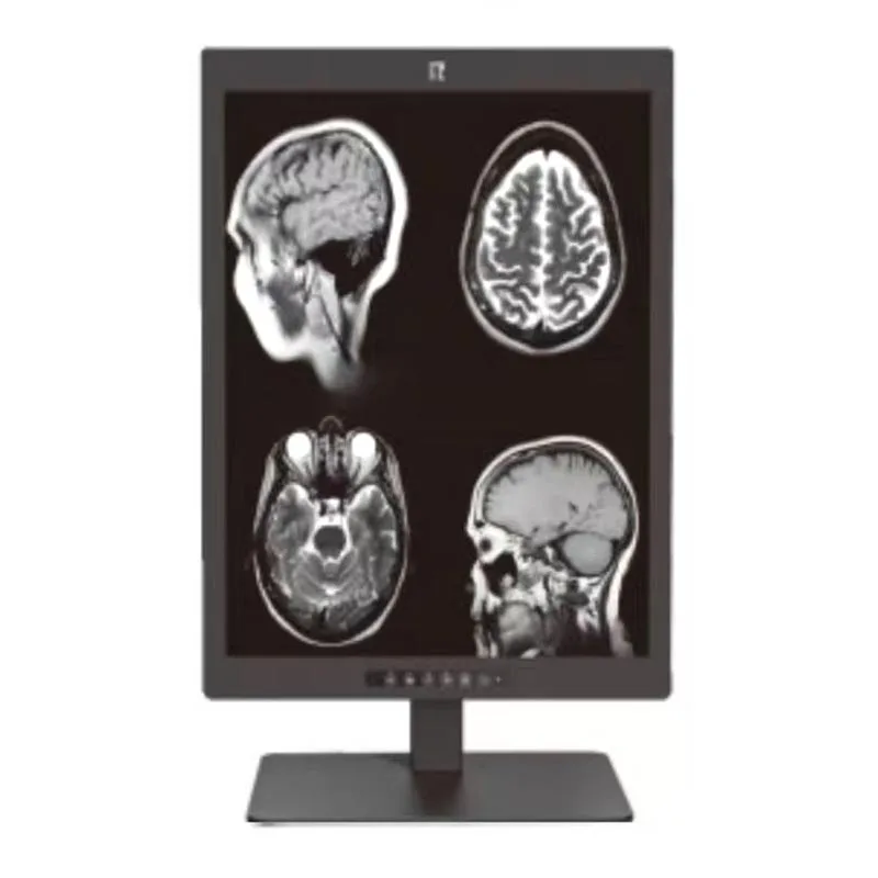 Écran de diagnostic médical 3MP de 21,3 pouces