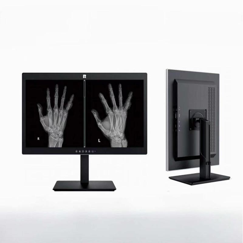 Moniteur de diagnostic médical 24 pouces 2MP