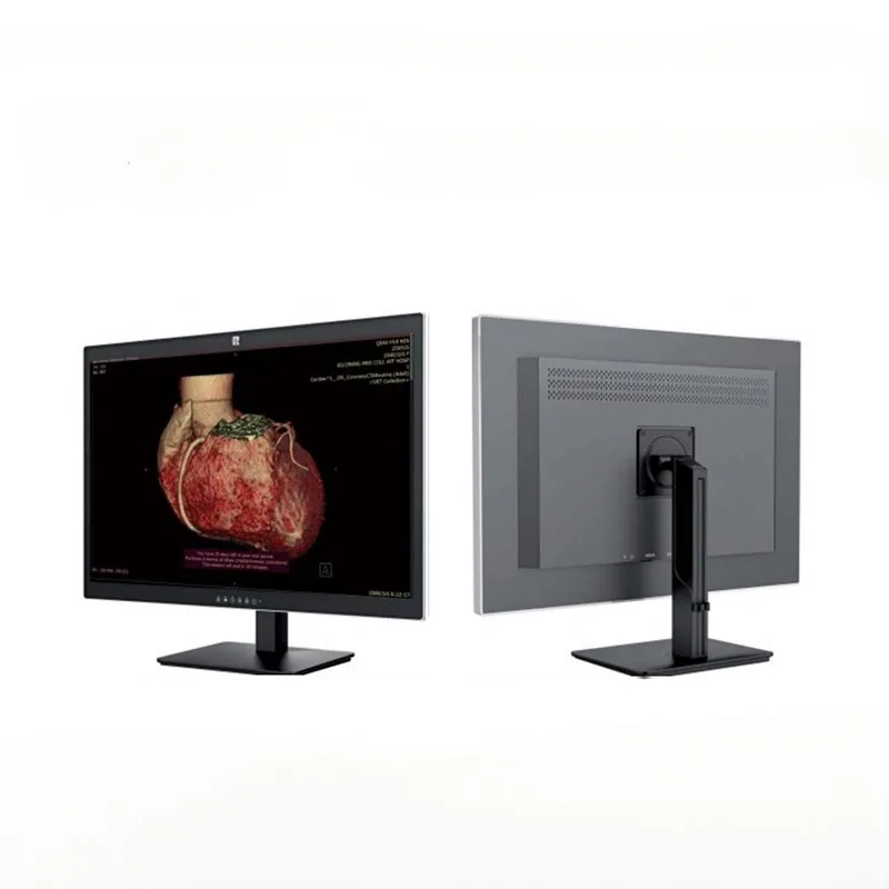 Moniteur de diagnostic médical 30 pouces 6MP