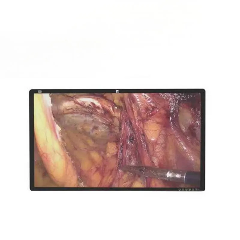 Moniteur médical chirurgical 4K de 32 pouces