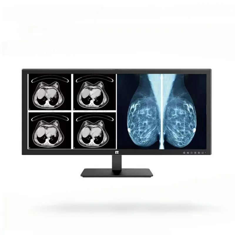 Moniteur de diagnostic médical 34 pouces 5MP