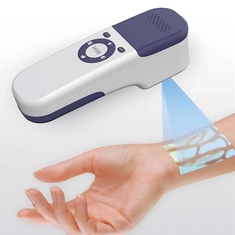 Color Vein Viewer